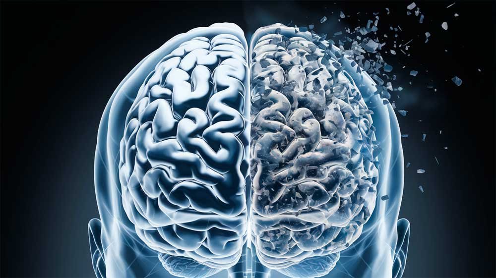 Microplásticos en el cerebro humano: Una amenaza invisible